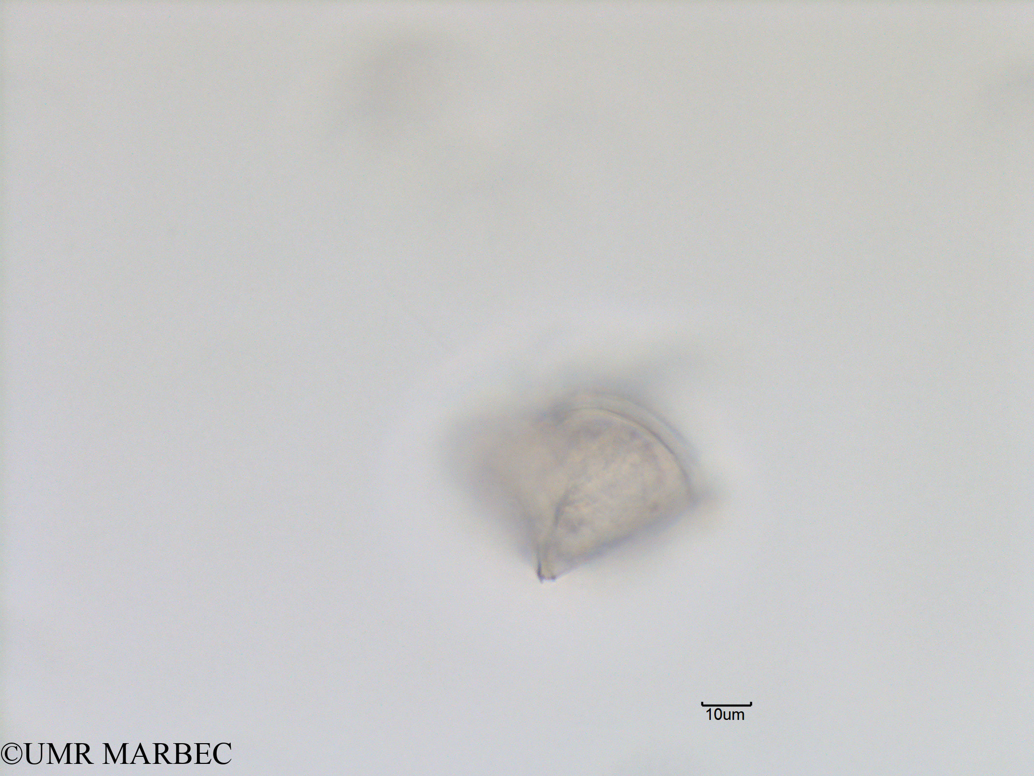phyto/Bizerte/bizerte_lagoon/RISCO November 2015/Protoperidinium sp48 (Lagune_T1_B_Proto lequel-10).tif(copy).jpg